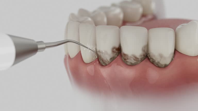 Trusted Dental Crowns And Bridges service in Mitchell, IL - Dentist Open Now